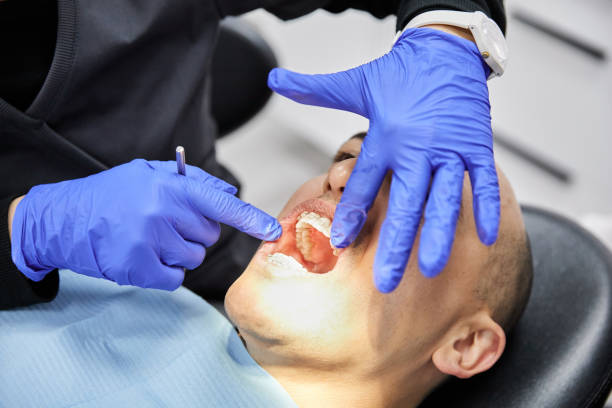 Best Emergency Wisdom Teeth Removal in Waynesboro, VA