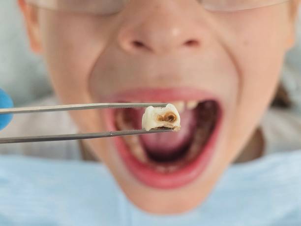 Best Emergency Gum Treatment in Waynesboro, VA