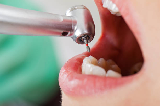 Best Pediatric Emergency Dentist in Waynesboro, VA